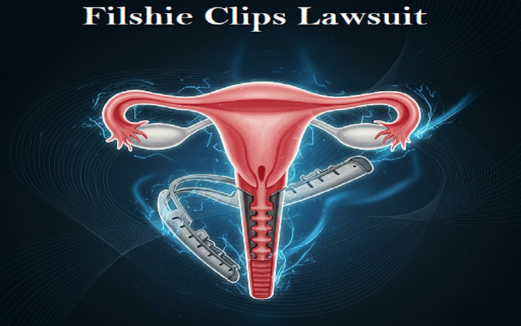 Read more about the article Filshie Clips Lawsuit: Risks, Migration & Your Legal Rights